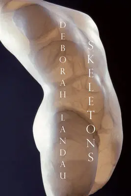 Landau, Deborah: Skeletons 1